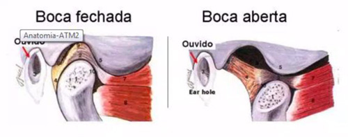 DTM e Dor Orofacial – Disfunção Temporomandibular (DTM) e Dor Orofacial