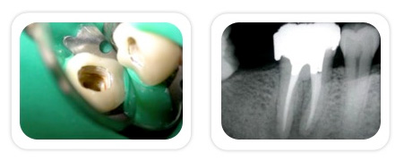 Endodontics