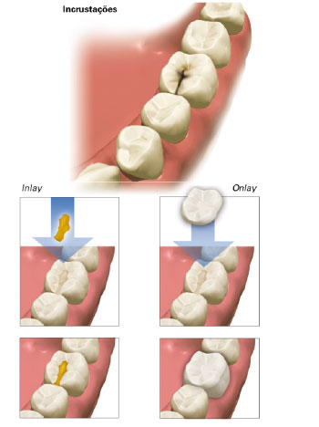 Odontologia Cosmética