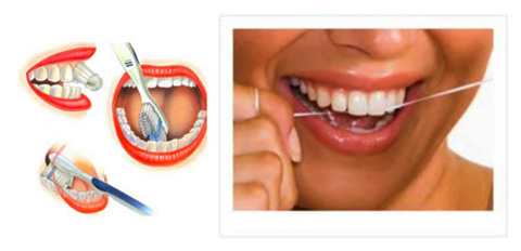 Brushing and flossing are essential to prevent periodontal disease.