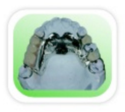 Prótese Parcial: São aparelhos removíveis combinados em resina com armação metálica indicados em casos de ausências parciais de dentes.